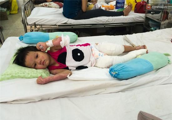 Bé gái 3 tuổi nghịch xăng bên bếp lẩu, cả gia đình bị thiêu sống - Ảnh 4.