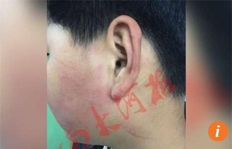 hieu truong bi to say xin, danh hoc sinh 9 tuoi nhap vien hinh anh 1