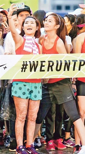 Selina khong ngai lo chan day seo sau tai nan hinh anh 1