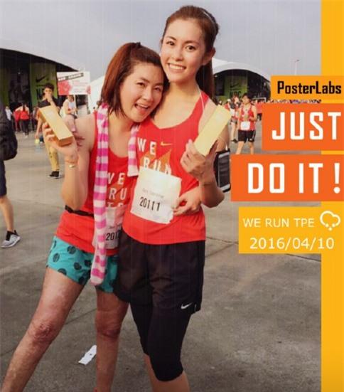 Selina khong ngai lo chan day seo sau tai nan hinh anh 2