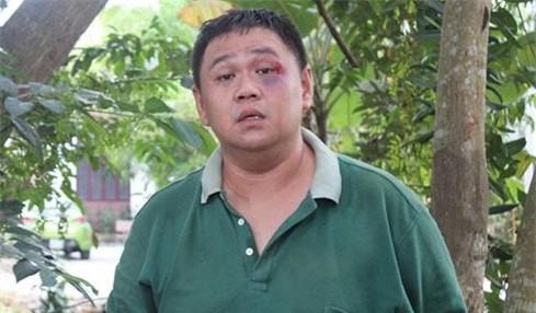 Nha chuc trach California dua du luat moi tu vu Minh Beo hinh anh 1