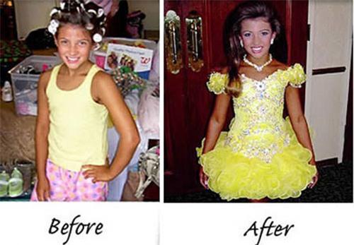 ep con gai tiem botox, nhuom da de thi hoa hau nhi - 12