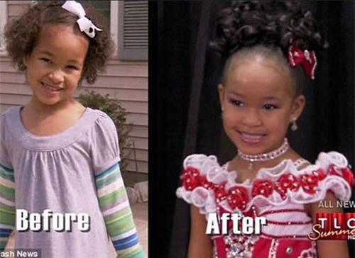 ep con gai tiem botox, nhuom da de thi hoa hau nhi - 3