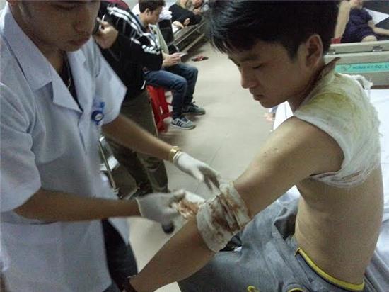 loi ke cua nan nhan vu no kinh hoang o nghe an hinh anh 2