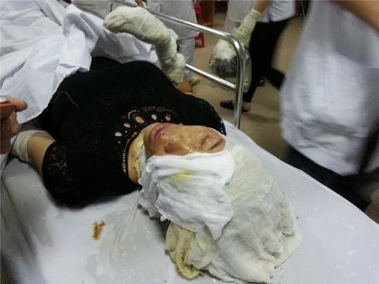 loi ke cua nan nhan vu no kinh hoang o nghe an hinh anh 3