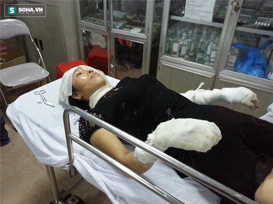 Sau vụ nổ, chị Vân bị thương nặng ở đầu, tay, bụng và chân.