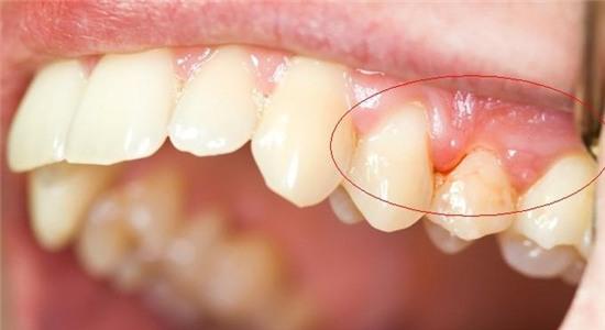 Hàm răng tiết lộ nhiều điều về sức khỏe của bạn