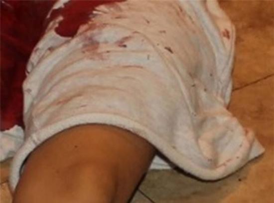 hien-truong-dam-mau-noi-pistorius-ban-chet-ban-gai-2