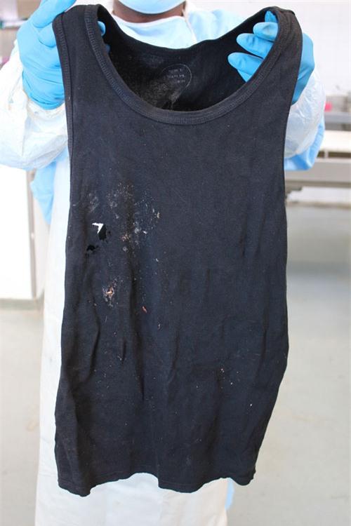 hien-truong-dam-mau-noi-pistorius-ban-chet-ban-gai-3