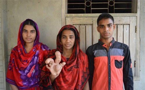 hiem gap: nguoi phu nu so huu ngon tay to di thuong hinh anh 2