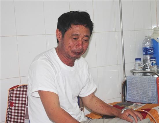 Bệnh nhân Trương Như La hiện đang điều trị tại Bệnh viện đa khoa Tp Vinh với những triệu chứng dị ứng sau khi ăn cá biển.