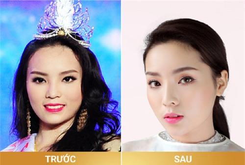 Kỳ Duyên, tiêm mũi, tiêm cằm, phẫu thuật thẩm mỹ, nói dối