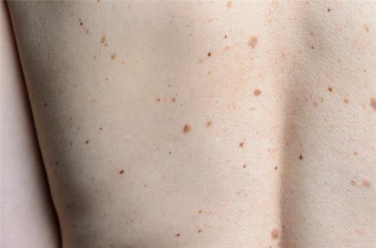 dấu hiệu ở da cảnh báo bệnh2