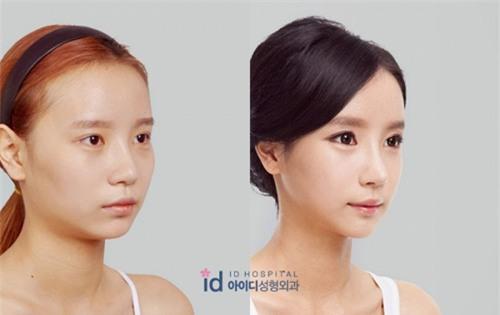 Sốc vì nhan sắc nguyên bản của hot girl đình đám xứ Hàn - 4