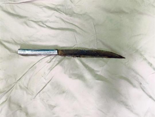 
Con dao với phần mũi dao sắc nhọn được lấy ra khỏi đầu nạn nhân

