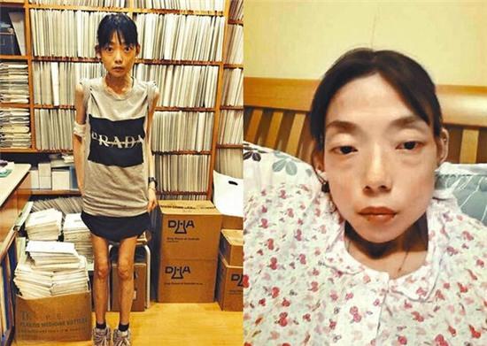 My nhan TVB bi to giat chong trong ngay cuoi hinh anh 2