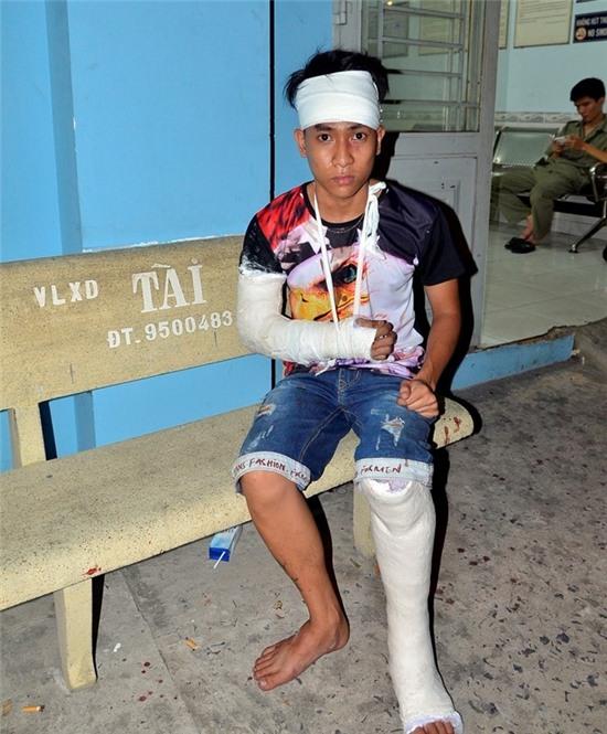 Giang ho dung ma tau chem bi thuong nhieu nguoi o Sai Gon hinh anh 1