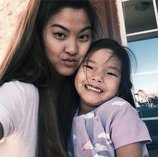 Cô chị có tâm đăng ảnh em gái bị ngỗng tấn công lên mạng mua vui - Ảnh 1.