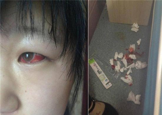 nhiem doc tu ban hoc trung quoc, mat hoc sinh do nhu ma ca rong hinh anh 1