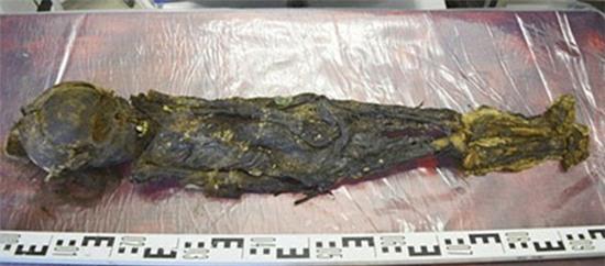 xet-nghiem-adn-xac-uop