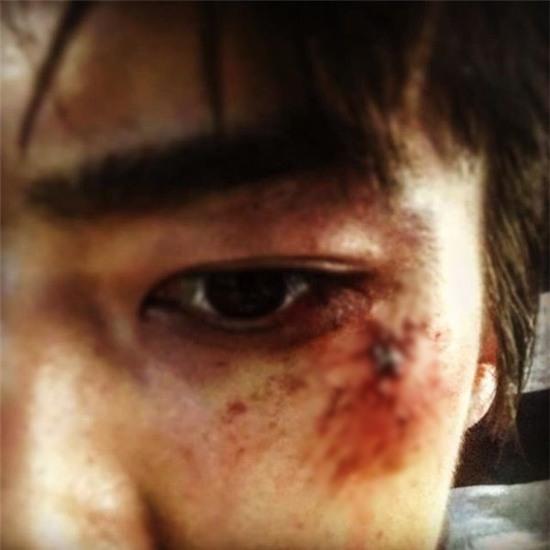 Fan hết hồn khi Sehun (EXO) đăng ảnh bị thương đầy máu me - Ảnh 3.