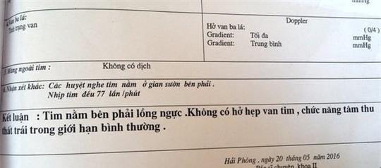 Nam thanh niên ngỡ ngàng phát hiện tim mình ở ngực bên phải - Ảnh 1.