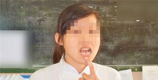 2 lần từ chối lời mời đi chơi bị bạn trai đánh rớt răng - Ảnh 1.