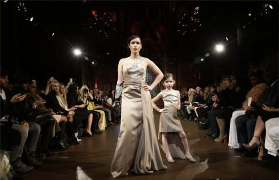 người mẫu cụt tay