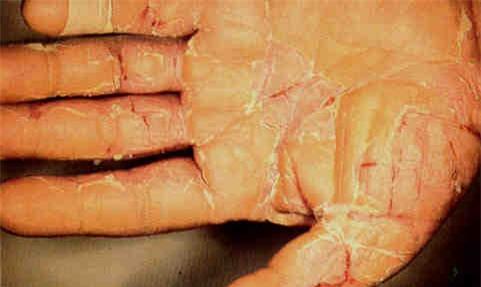 Những hình ảnh đáng sợ khi trẻ bị nhiễm độc chì - Ảnh 4.