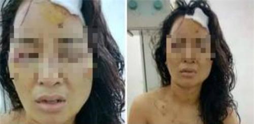 Lộ tin nhắn khiến cô giáo bị chồng cũ đánh bầm tím khắp cơ thể - Ảnh 2