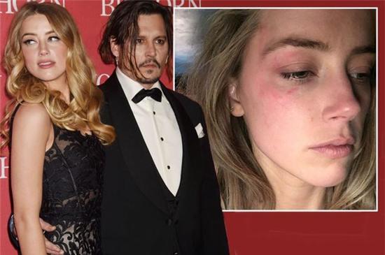 Thêm bằng chứng Amber Heard gian dối khi tố Johnny Depp bạo hành - Ảnh 1.