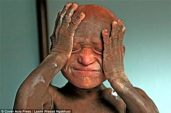 benh-la-khien-cau-be-trong-nhu-tuong