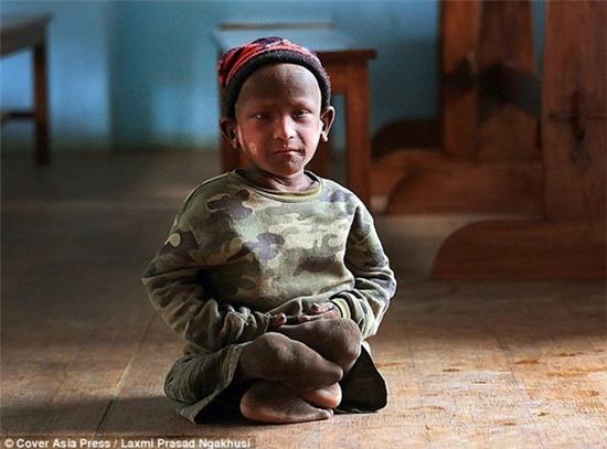 benh-la-khien-cau-be-trong-nhu-tuong