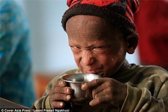 benh-la-khien-cau-be-trong-nhu-tuong