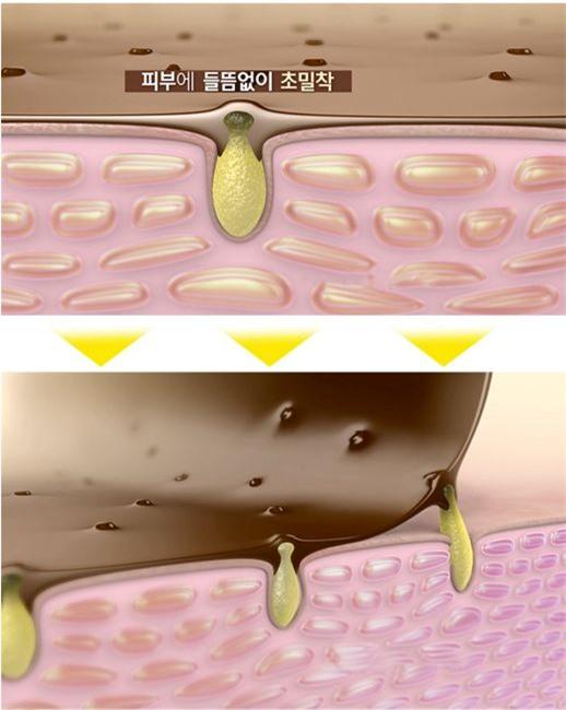 trị mụn đầu đen