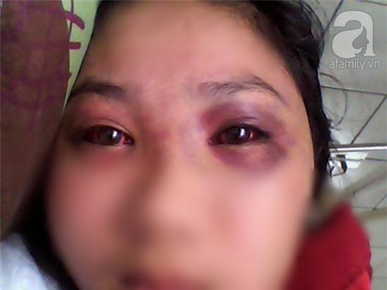 Nữ sinh viên tố bị bạn trai cưỡng hiếp, bóp cổ và dùng dao lam cắt tay bắt phải chết - Ảnh 1.