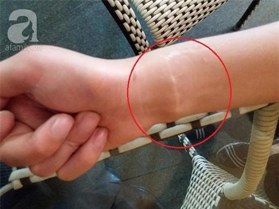 Nữ sinh viên tố bị bạn trai cưỡng hiếp, bóp cổ và dùng dao lam cắt tay bắt phải chết - Ảnh 3.