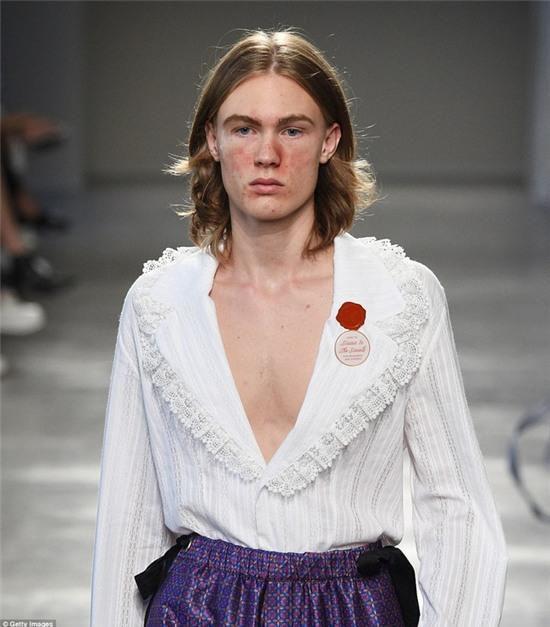 Show diễn thời trang gây giật mình với dàn mẫu mặt đầy mụn đỏ - Ảnh 1.