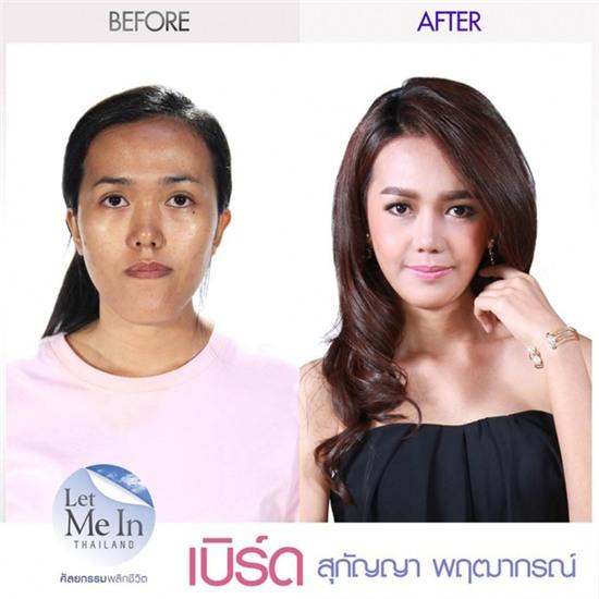 9x Thái từng bị nhận xét là xúc phạm người nhìn, và cuộc lột xác ngoạn mục sau PTTM - Ảnh 2.