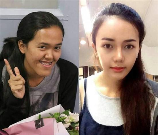 9x Thái từng bị nhận xét là xúc phạm người nhìn, và cuộc lột xác ngoạn mục sau PTTM - Ảnh 3.