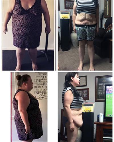 cap-vo-chong-giam-172-kg-chi-trong-mot-nam-3