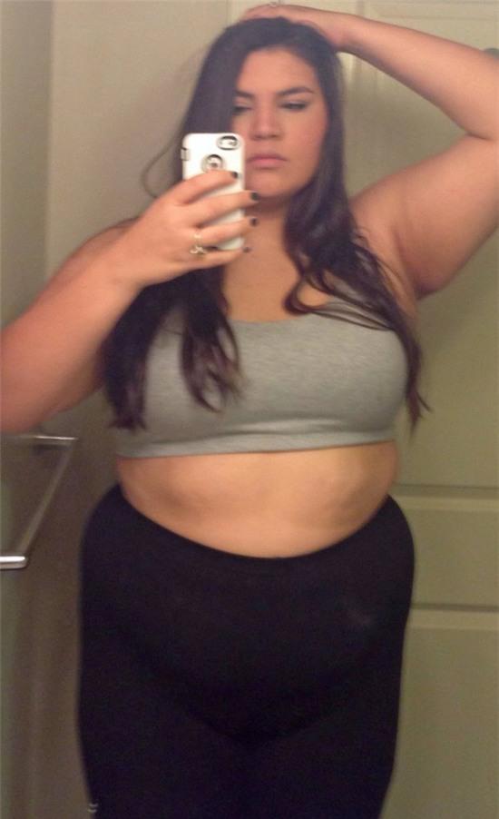 giảm cân không dao kéo