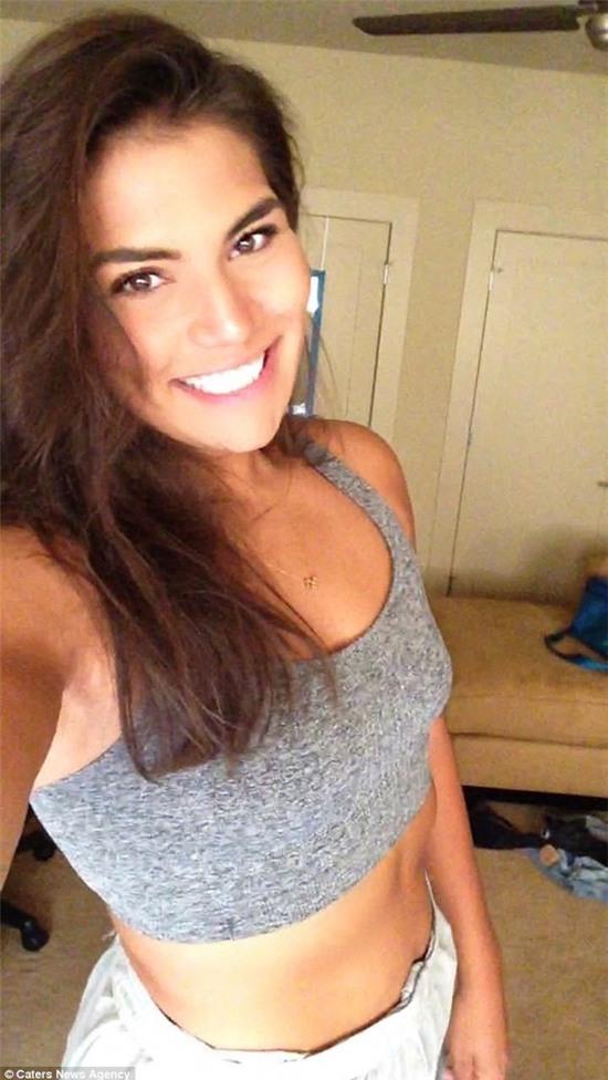 giảm cân không dao kéo