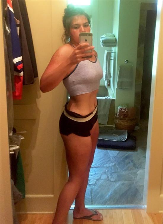 giảm cân không dao kéo