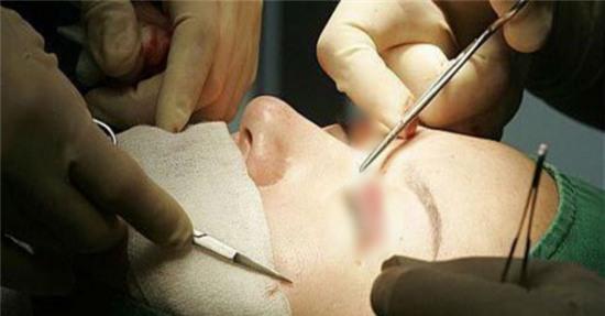 Sau nửa năm đi cắt mí mắt, nữ sinh bỗng phát hiện bị nhiễm HIV - Ảnh 1.