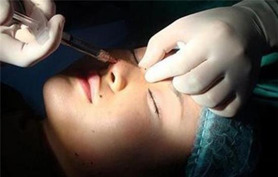 Sau nửa năm đi cắt mí mắt, nữ sinh bỗng phát hiện bị nhiễm HIV - Ảnh 3.