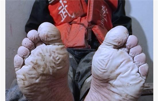 Tay thủng lỗ chỗ, chân nhăn nhúm vì xả thân cứu hộ trong trận lũ lịch sử tại Trung Quốc - Ảnh 13.