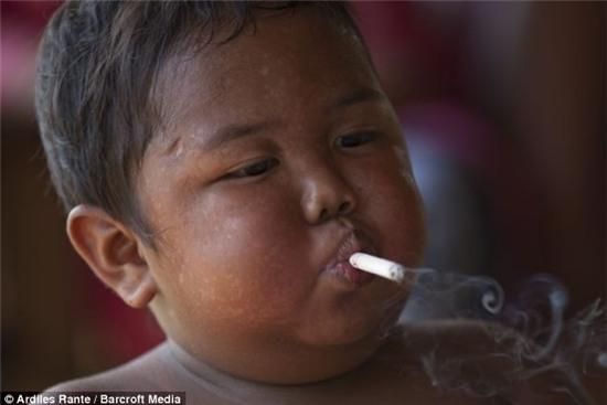 Bạn có còn nhớ cậu bé Indonesia 5 tuổi hút 40 điếu thuốc một ngày? Đây là cậu 8 năm sau - Ảnh 1.