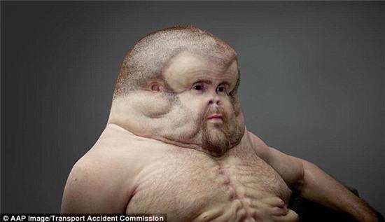 The body of Graham with his huge chest, inflated head and absence of a neck has been designed to survive a car crash