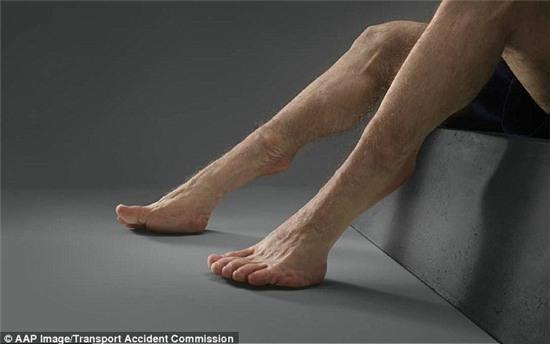 Dr Kenfield said even the strongest man could not hold himself in place in a car accident because the force of crash was so great